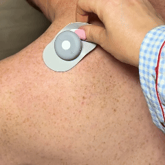 Applying a NuSpine pod to the lower back