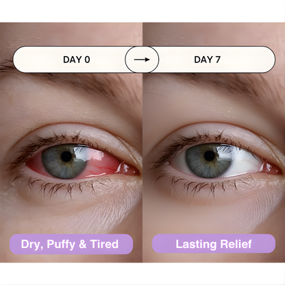 EyeRevive - Steam eye mask
